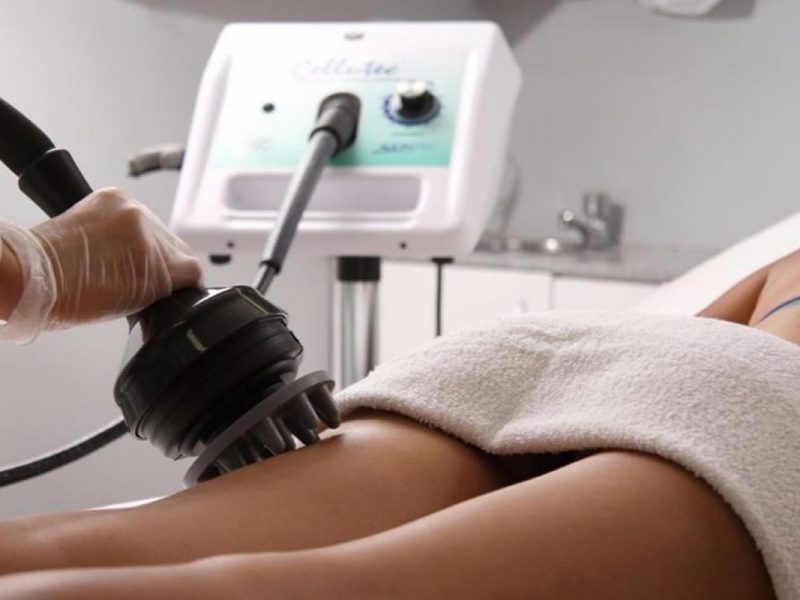 Slimming with G5