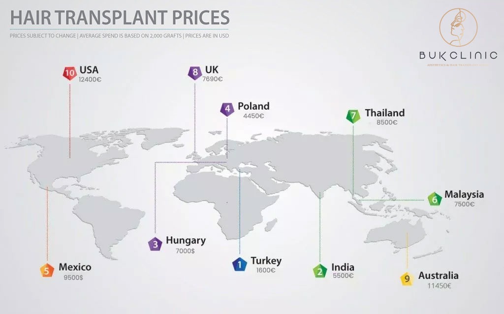 Hair Transplant World Prices 