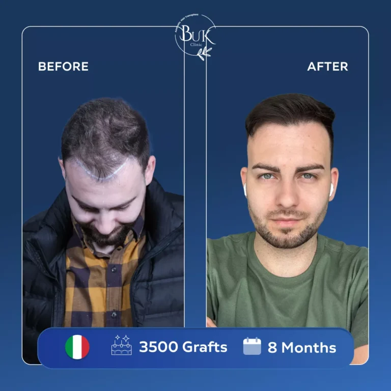 Homepage 12 before-after-11