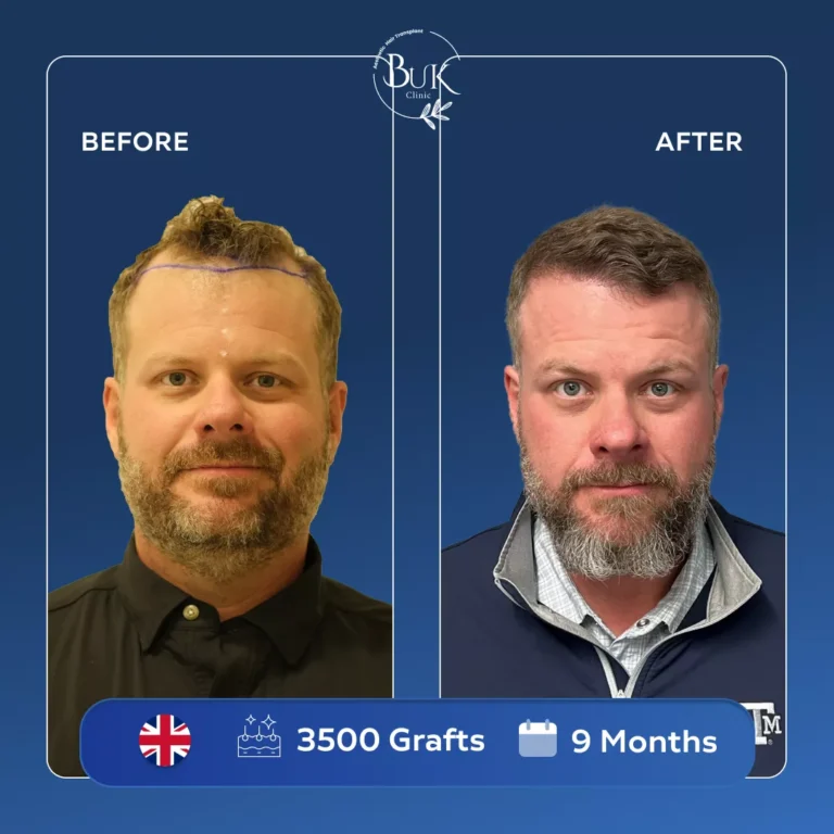 Homepage 3 before-after-2