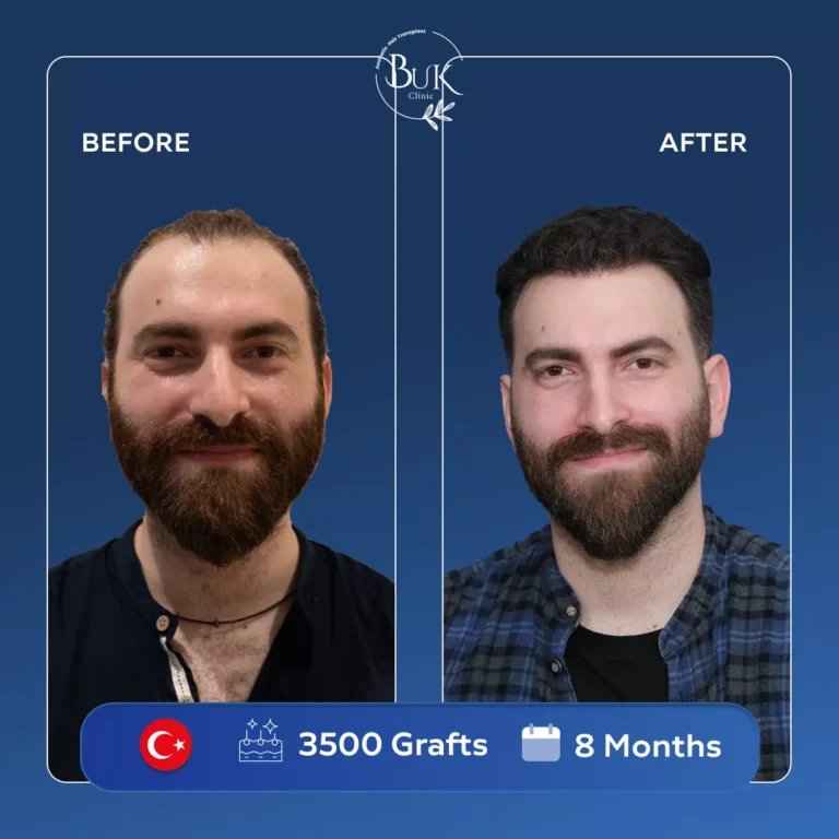 Homepage 4 before-after-3