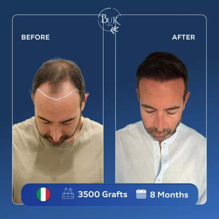 Homepage 8 before-after-7